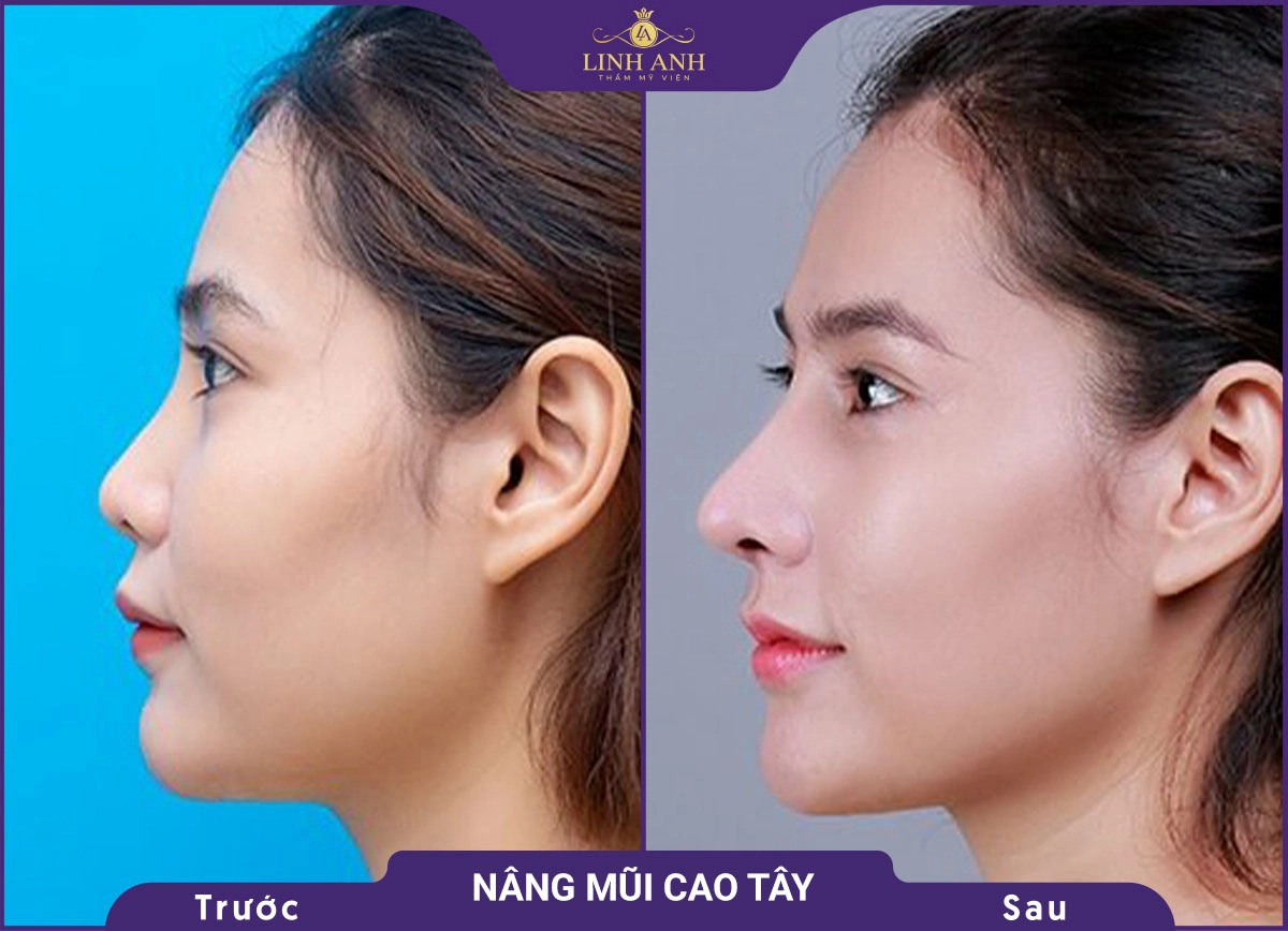 bf af nang mui 6
