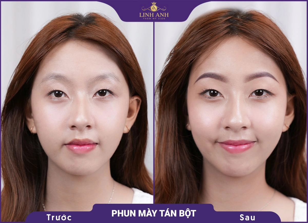 bf af phu xam chan may 1