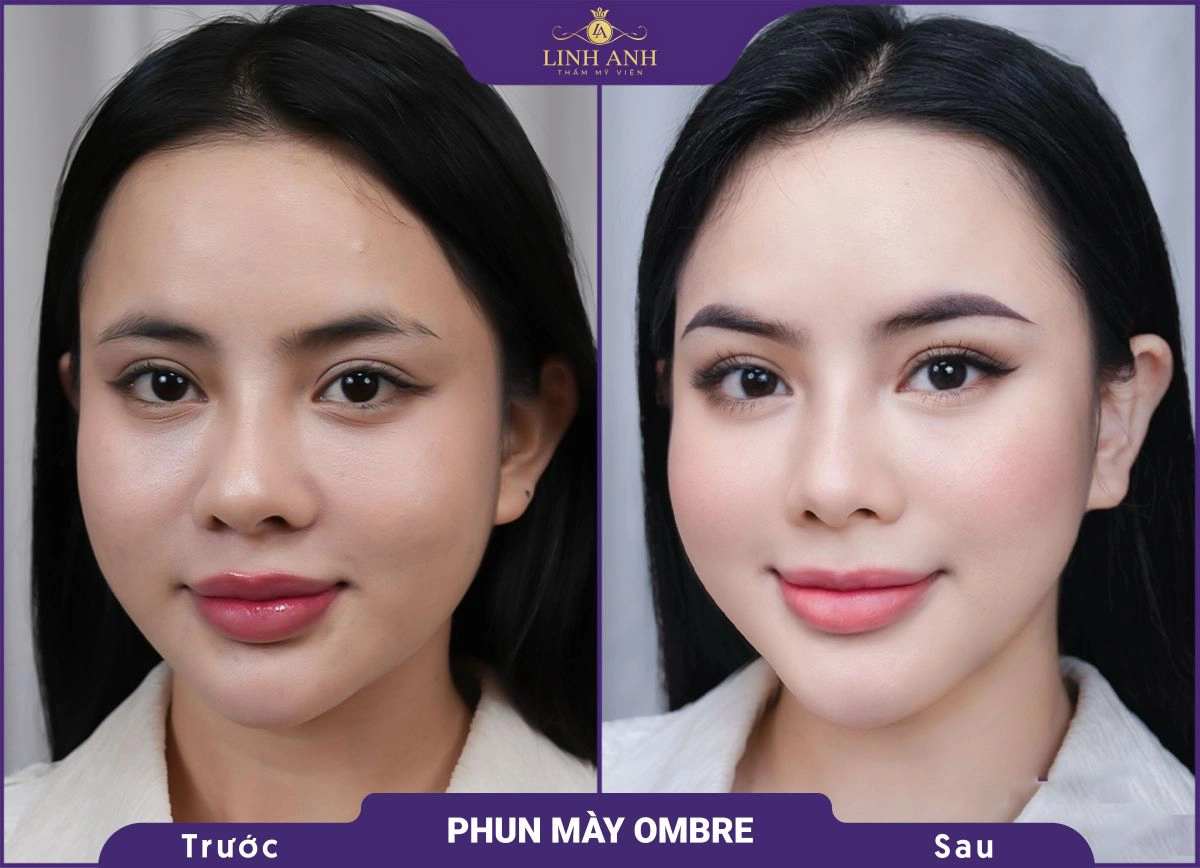 bf af phu xam chan may 2