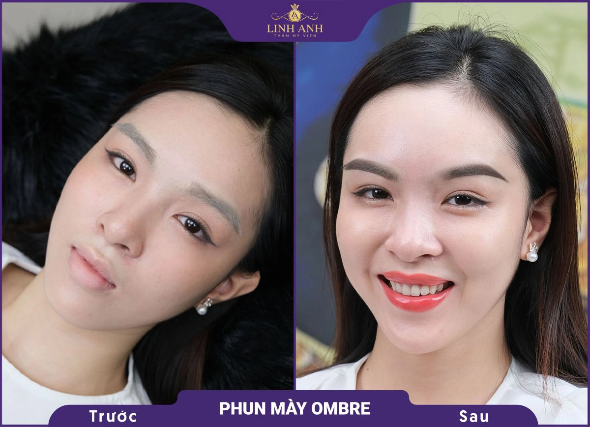 bf af phu xam chan may 4