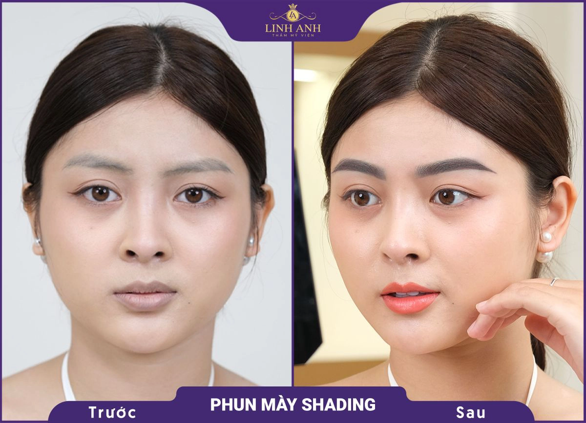 bf af phu xam chan may 6