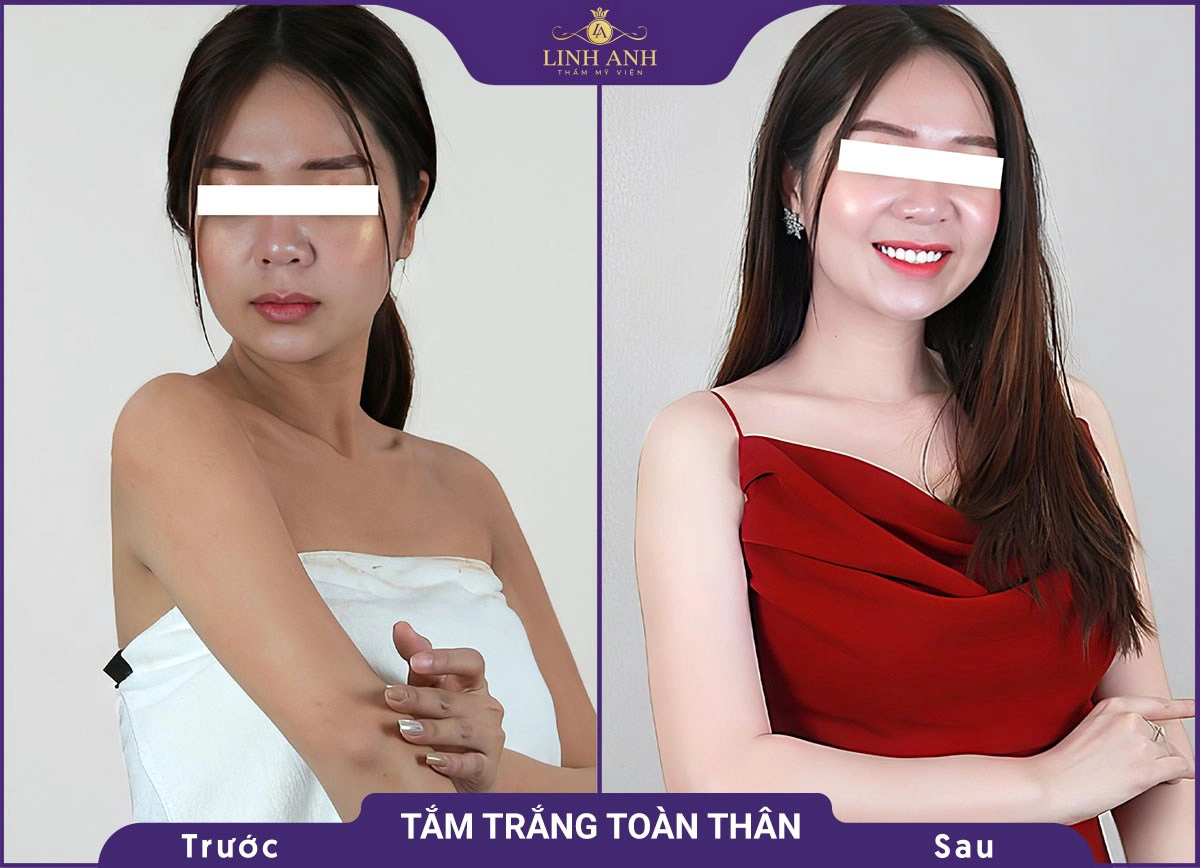 bf af tam trang 1