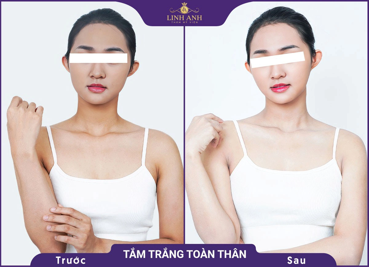 bf af tam trang 2