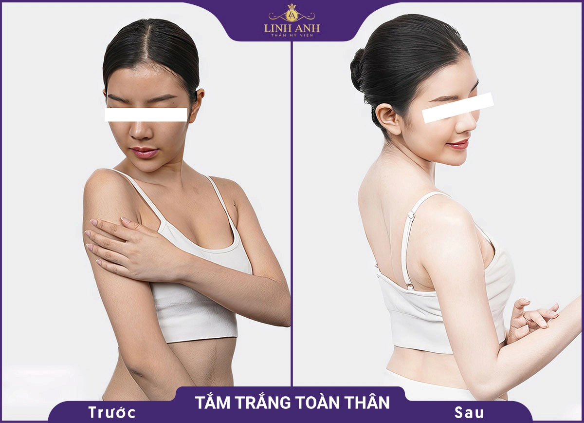bf af tam trang 3