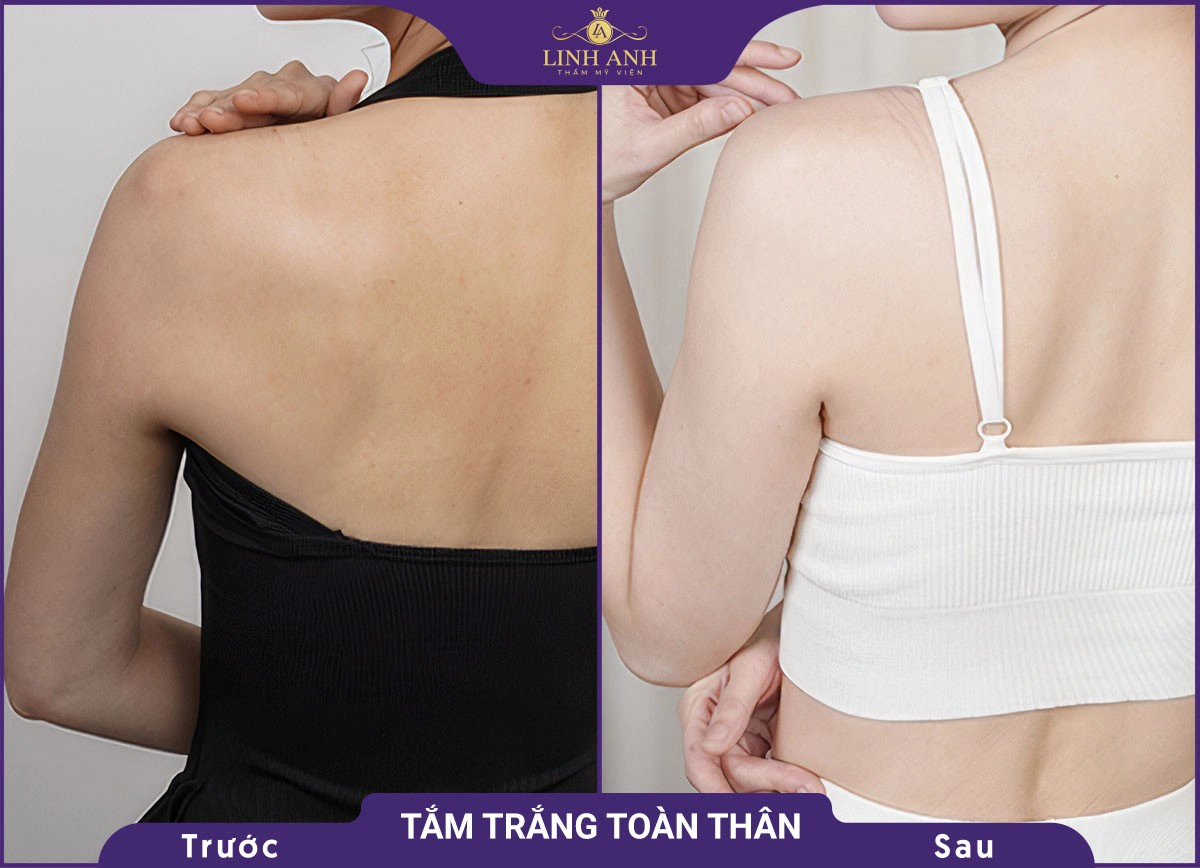 bf af tam trang 4
