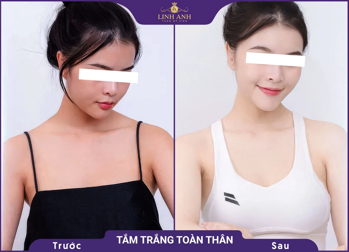 bf af tam trang 5