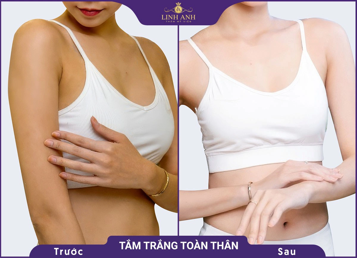 bf af tam trang 6