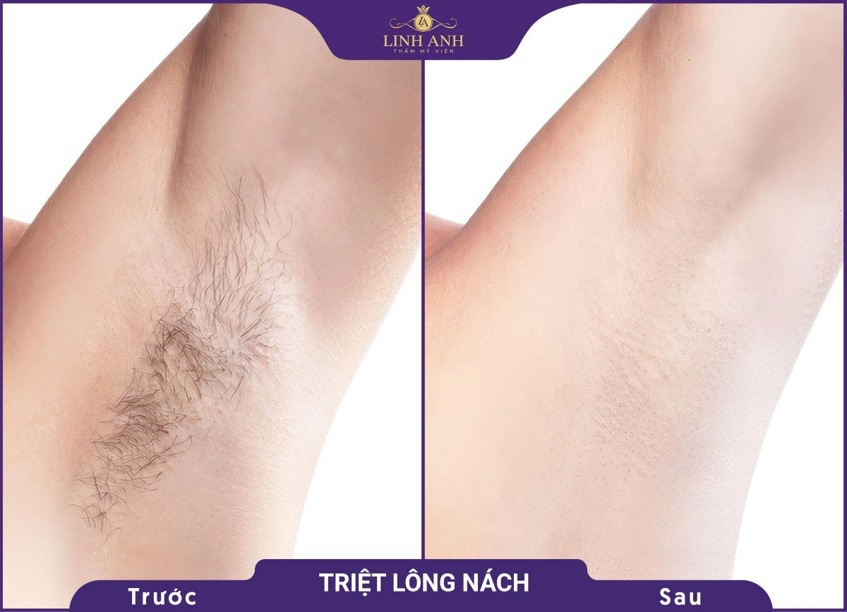 bf af triet long 1