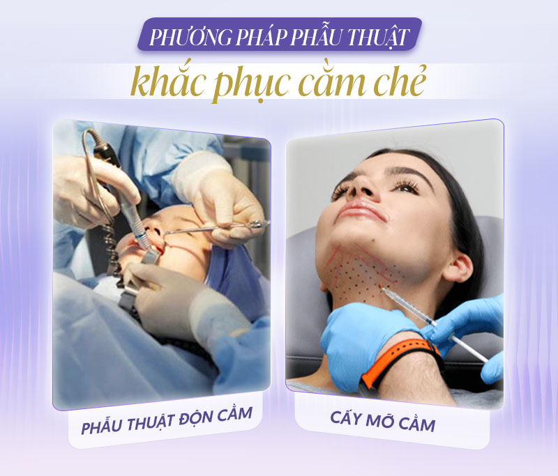 Những phương pháp phẫu thuật thẩm mỹ khắc phục cằm chẻ.