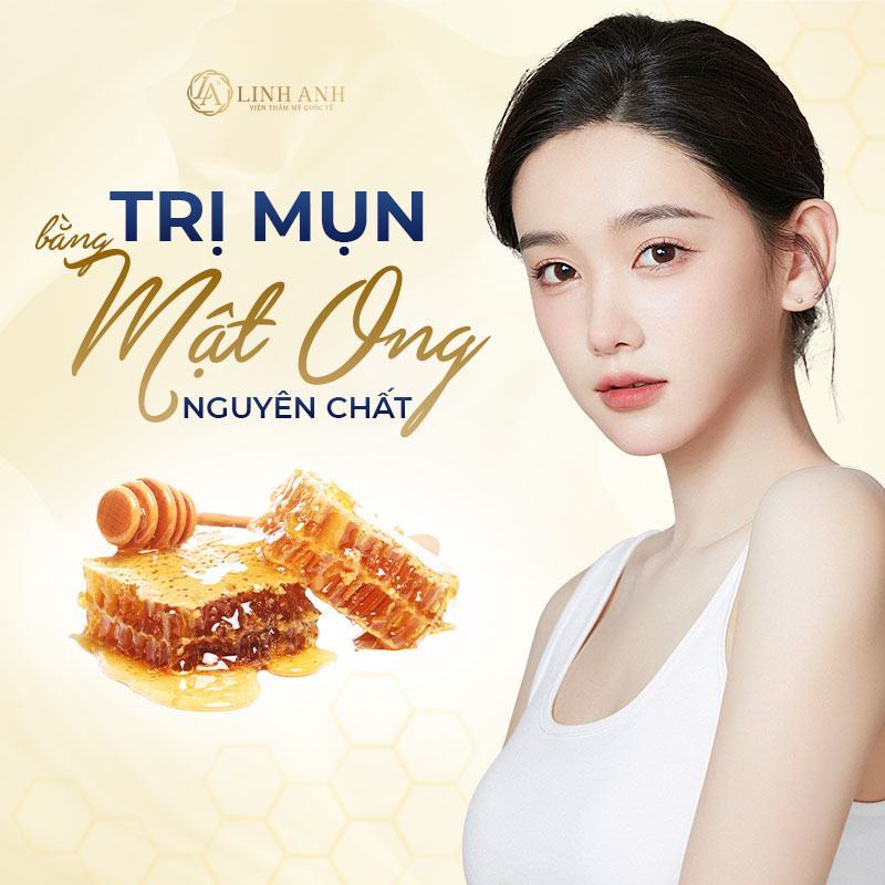 cách trị mụn bằng mật ong tại nhà - Viện thẩm mỹ quốc tế Linh Anh