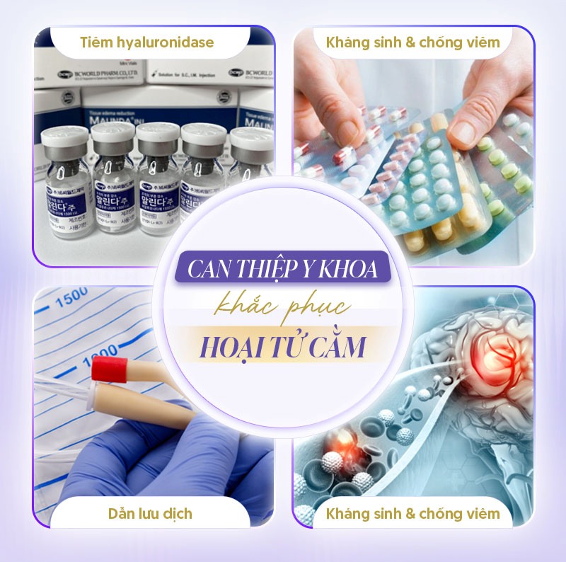 Cách xử lý tiêm filler bị hoại tử cằm