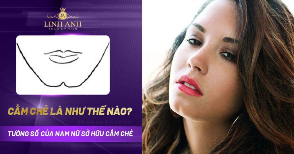 Cằm chẻ