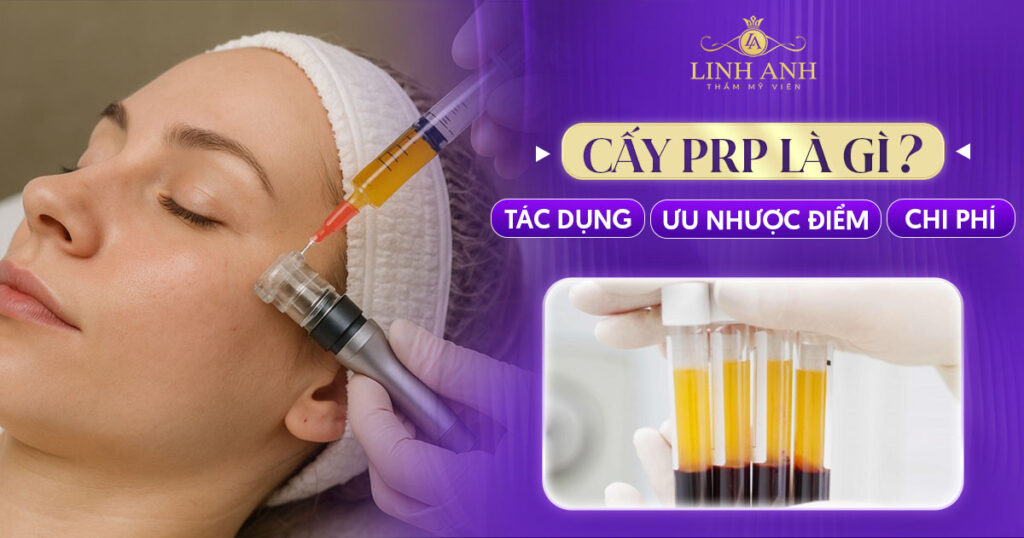 cấy PRP là gì