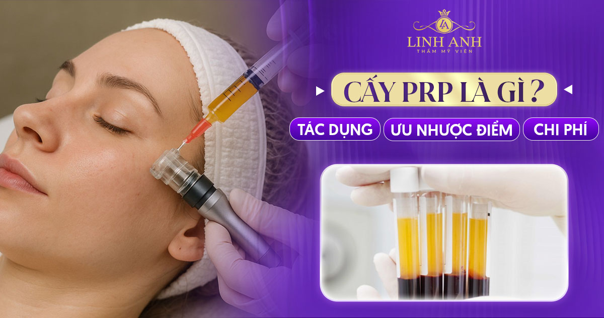 Cấy PRP là gì? Tác dụng, ưu điểm, chi phí cấy máu tự thân
