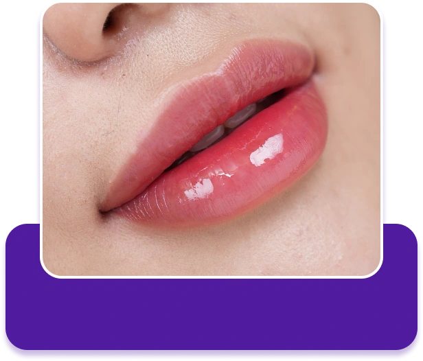 Dịch vụ Cấy môi Diamond Lips