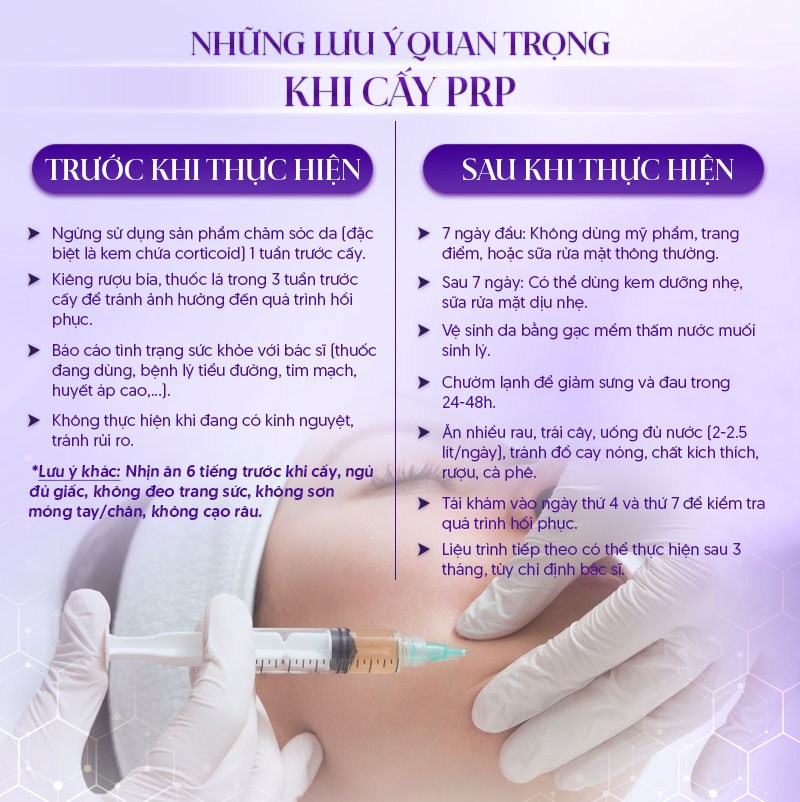 cấy prp