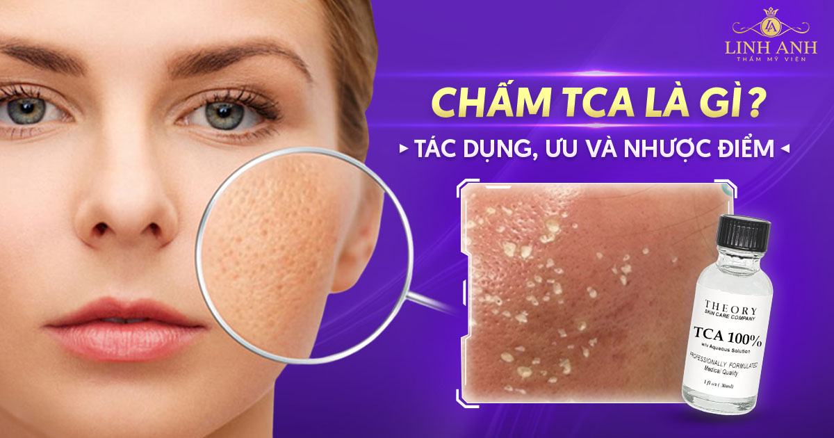 Chấm TCA là gì? Tác dụng, ưu và nhược điểm