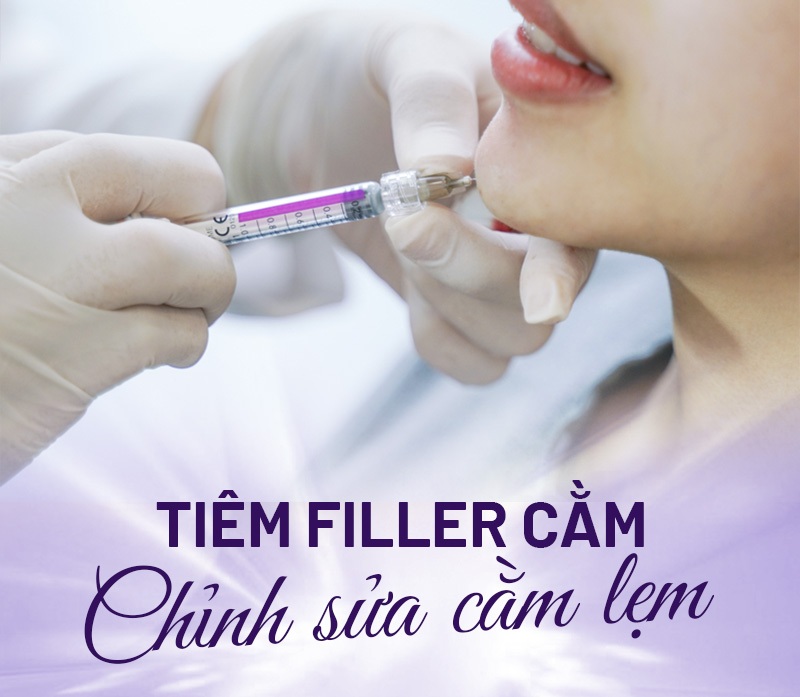 Chữa cằm lẹm không phẫu thuật