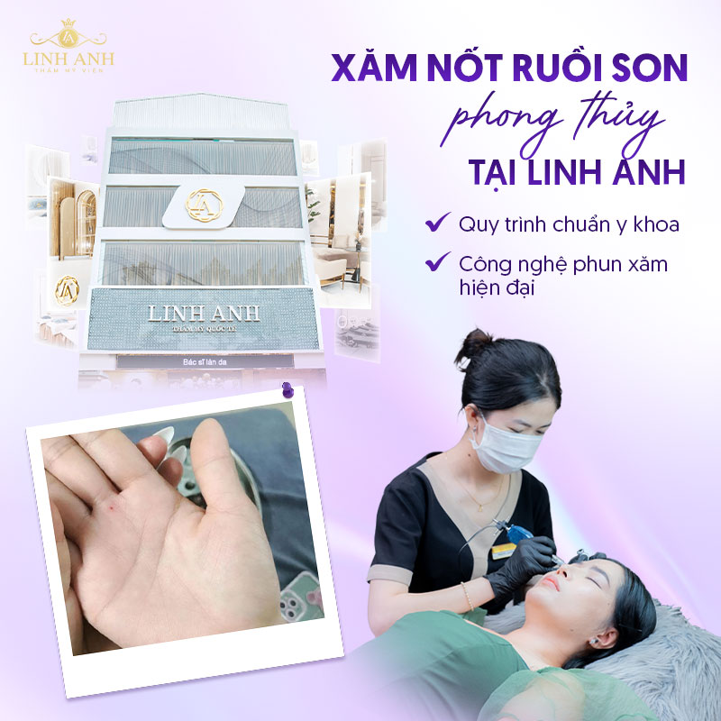 có nên xăm nốt ruồi son