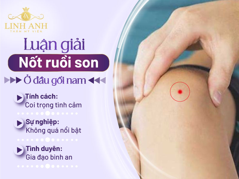 có nốt ruồi ở đầu gối