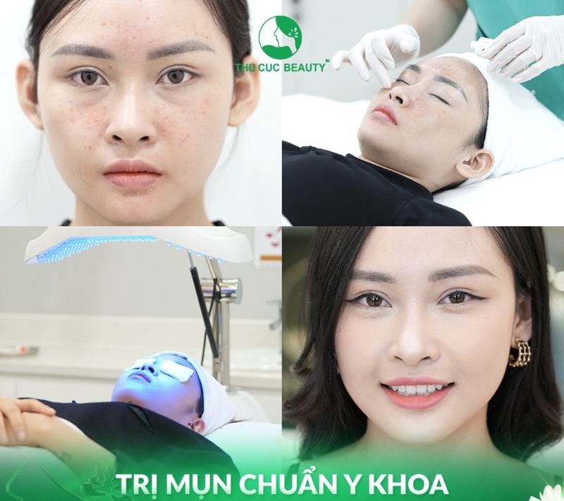 địa chỉ nặn mụn uy tín tại tphcm
