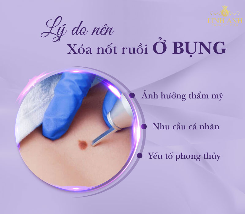 Địa chỉ tẩy nốt ruồi ở bụng