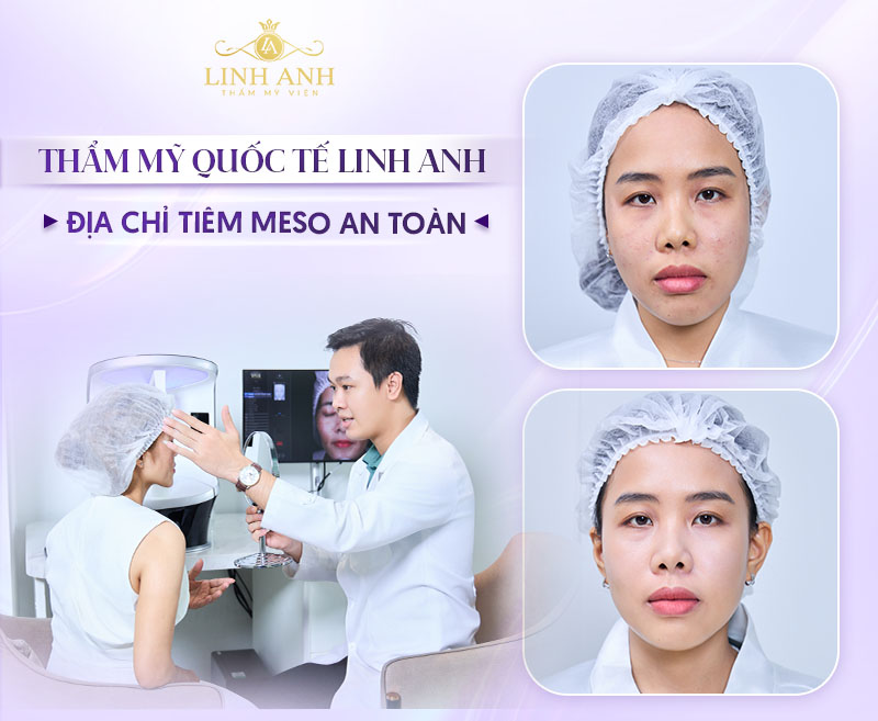 Địa chỉ tiêm Meso tại TPHCM