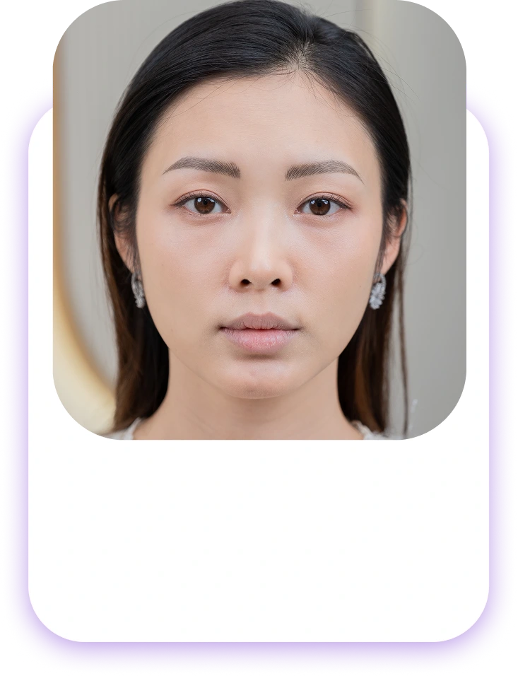 Đối tượng nên phun và cấy môi