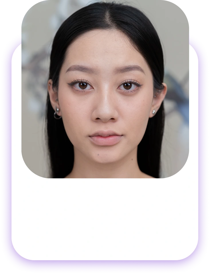 Đối tượng nên phun và cấy môi