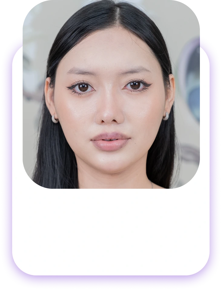 Đối tượng nên phun và cấy môi