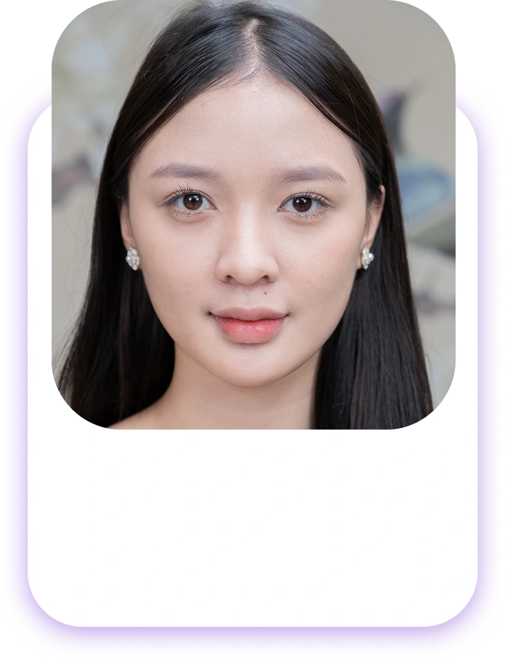 Đối tượng nên phun và cấy môi