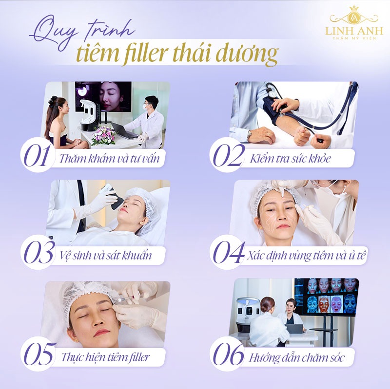 Filler thái dương