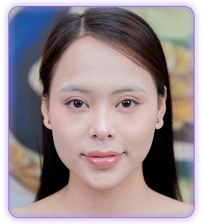 Lông mày thưa nhạt, thiếu đầu thiếu đuôi