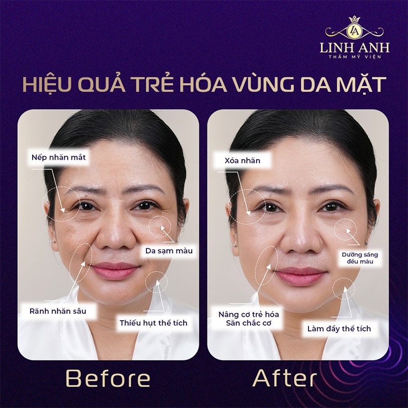 Karisma có tác dụng gì