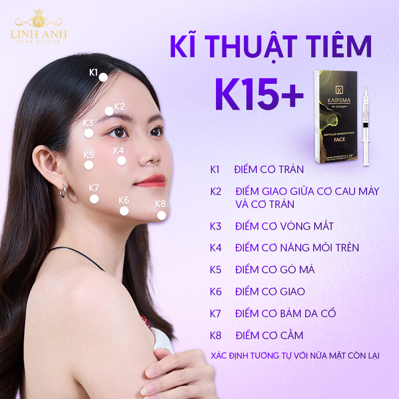 Karisma tiêm bao nhiêu điểm