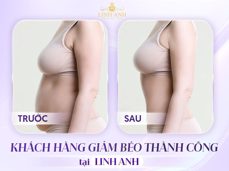 Khách hàng giảm béo bằng công nghệ cao