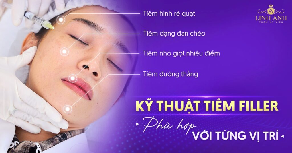 Kỹ thuật tiêm filler