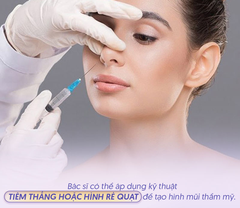 Kỹ thuật tiêm filler mũi