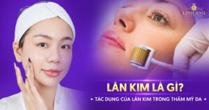 lăn kim