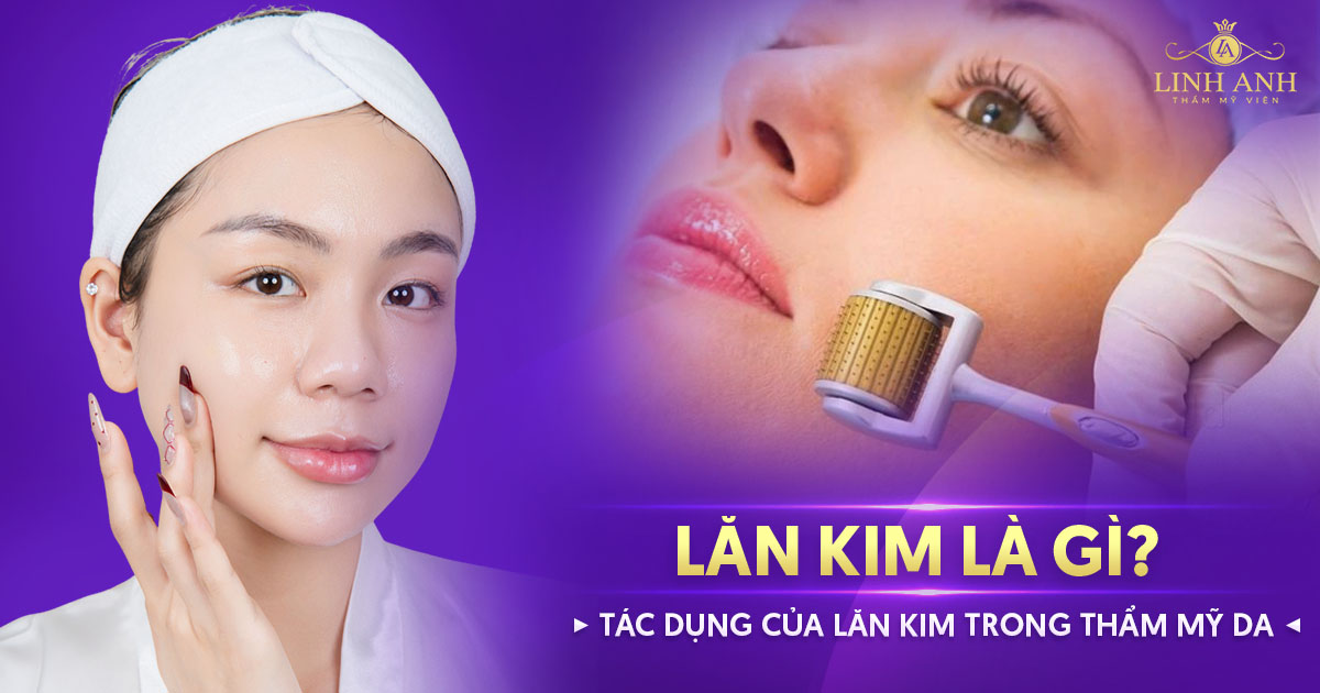 Lăn kim là gì? Tác dụng của lăn kim trong thẩm mỹ da