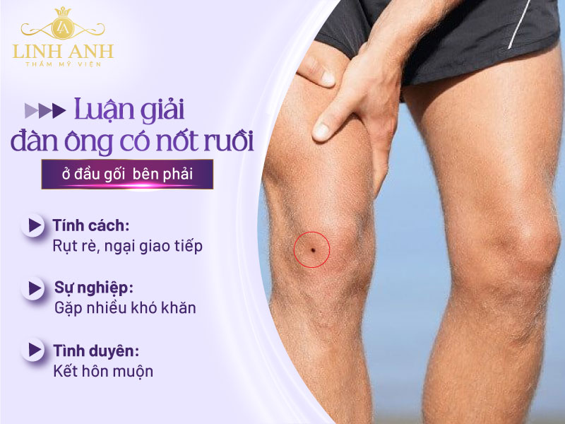 mụn ruồi ngay đầu gối