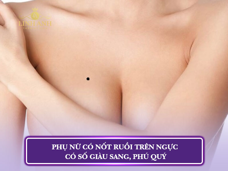 mụn ruồi ở giữa ngực