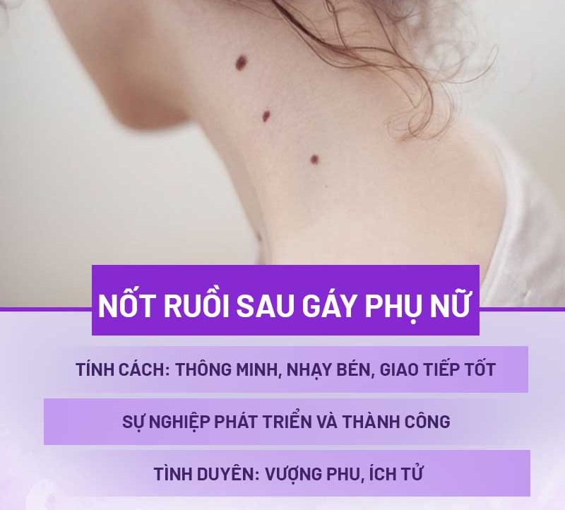 mụn ruồi sau gáy