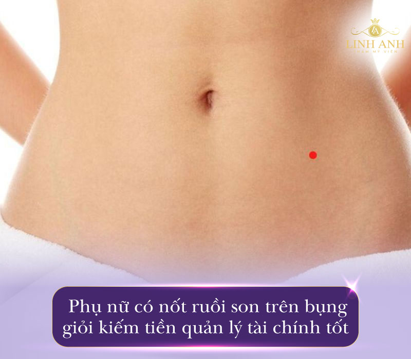 Mụn ruồi son ở bụng phụ nữ