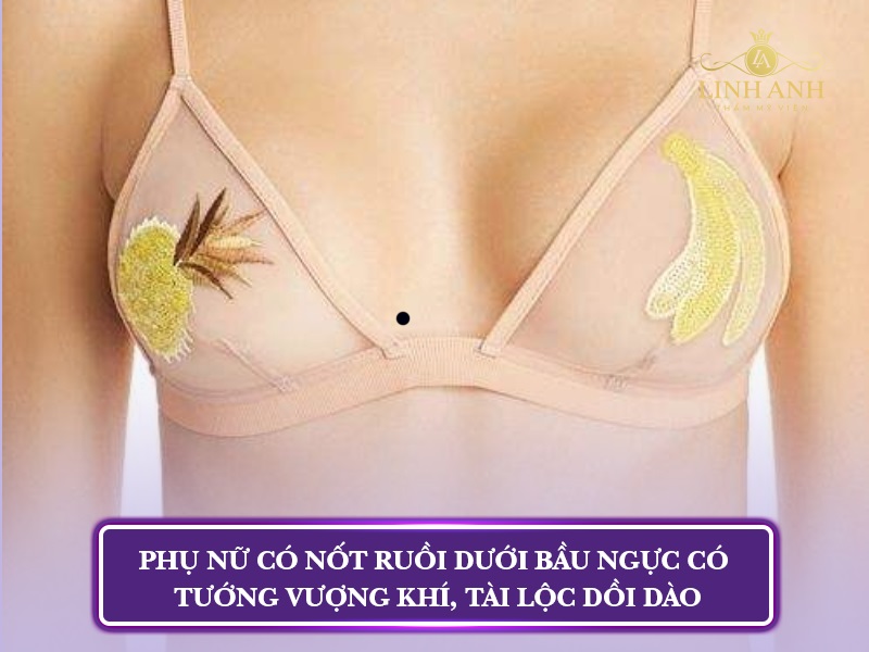 mụn ruồi trên ngực