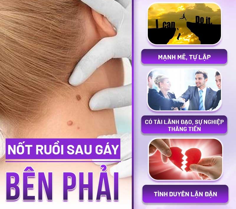 người có nốt ruồi sau gáy