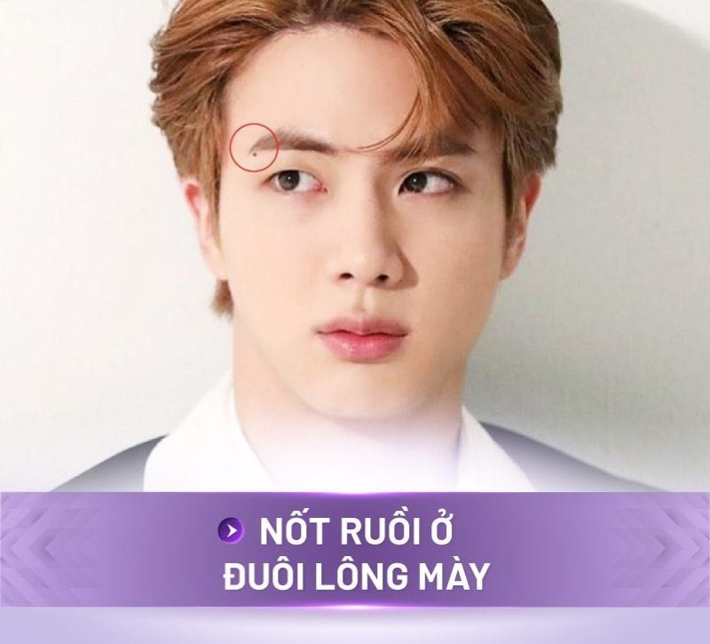 Những nốt ruồi không nên tẩy ở nam giới