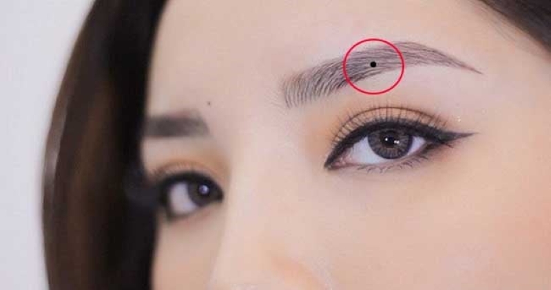 Những nốt ruồi không nên tẩy ở nữ giới
