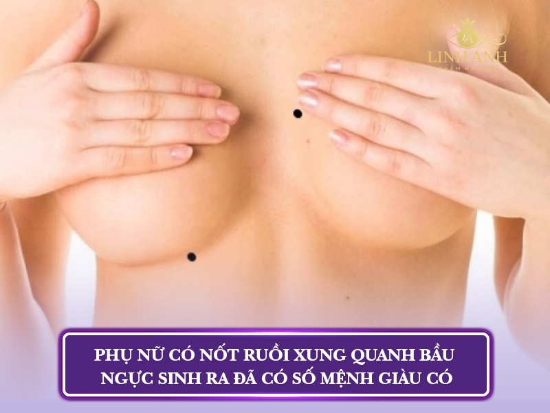 nốt nuồi ở giữa ngực