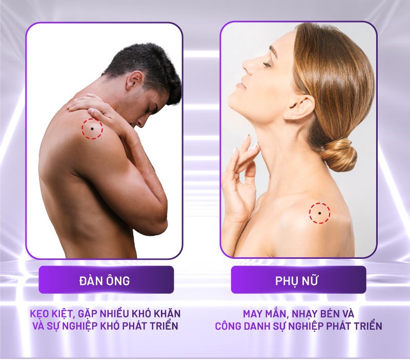 nốt ruồi bả vai nốt ruồi bả vai